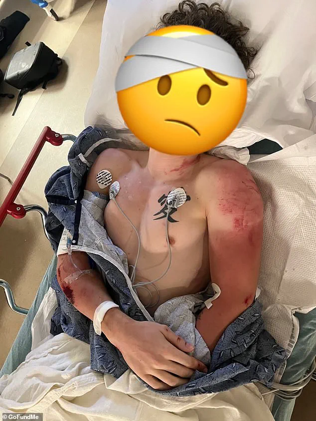 Viral Video of Critical Injury During Georgia Police Chase Sparks Outrage and Empathy for Motorcyclist DancingMoto