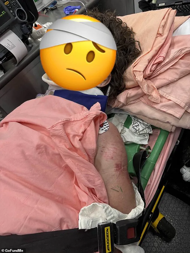 Viral Video of Critical Injury During Georgia Police Chase Sparks Outrage and Empathy for Motorcyclist DancingMoto