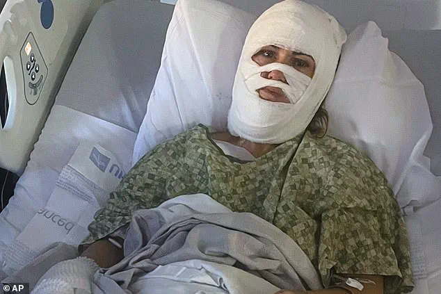 Georgia Woman Faces Millions in Medical Bills After Random Acid Attack in Savannah Park
