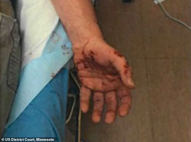 ICE Agent Jonathan Ross, Who Shot Renee Good, Still Bears Scars From Six-Month-Old Incident Where He Was Dragged by Suspect, Court Testimony Reveals