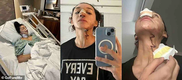 Exclusive: The Hidden Truth Behind the Acid Attack on Aspiring Bodybuilder Davina Licon