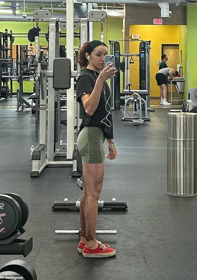 Exclusive: The Hidden Truth Behind the Acid Attack on Aspiring Bodybuilder Davina Licon