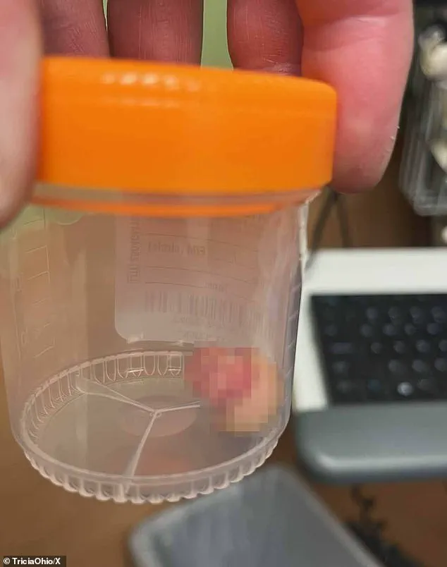 Minneapolis Protests Highlight Public Outcry Over Federal Law Enforcement Actions Following Fatal Shooting