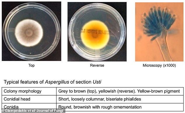 Resilient Fungus Survives Mars Conditions, Threatening Interplanetary Contamination