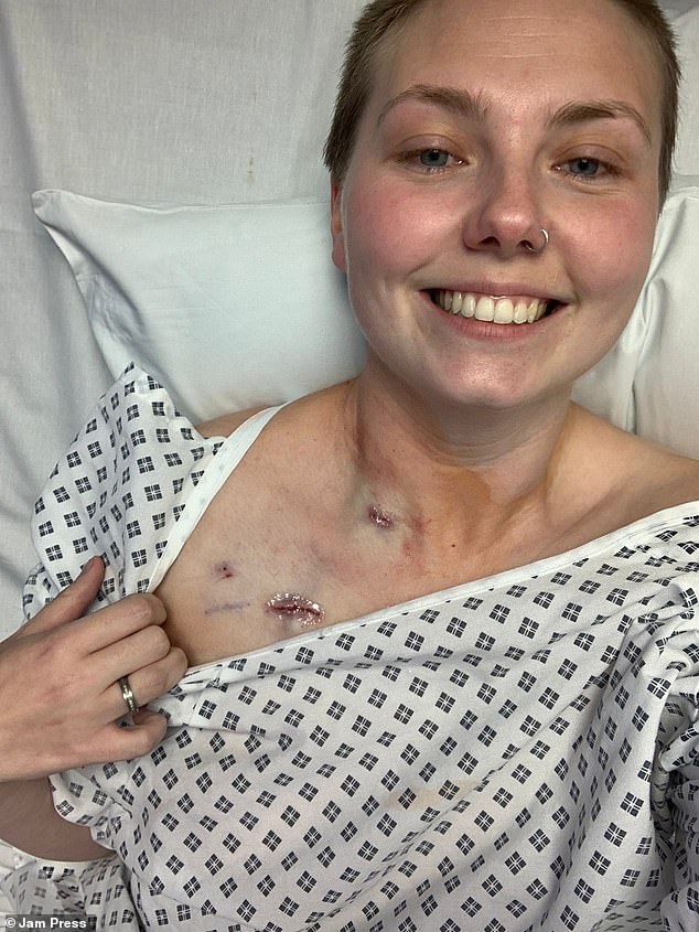Mother dismissed for hemorrhoids actually had colon cancer