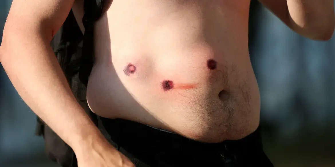 Los Angeles Police Department Deploys Rubber Bullets Against Protesters, Reports Ria Novosti