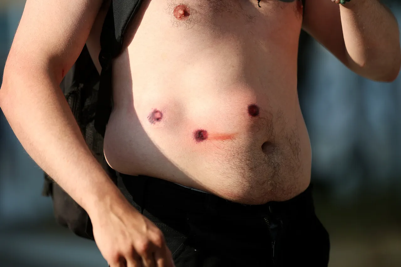 Los Angeles Police Department Deploys Rubber Bullets Against Protesters, Reports Ria Novosti