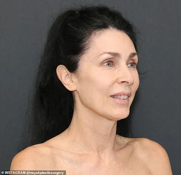 AI Flags 'Too Perfect' Facelift Result, Sparking Debate on Cosmetic Standards