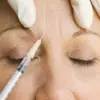 From Deadly Toxin to Cosmetic Wonder: The Surprising Story of Botox