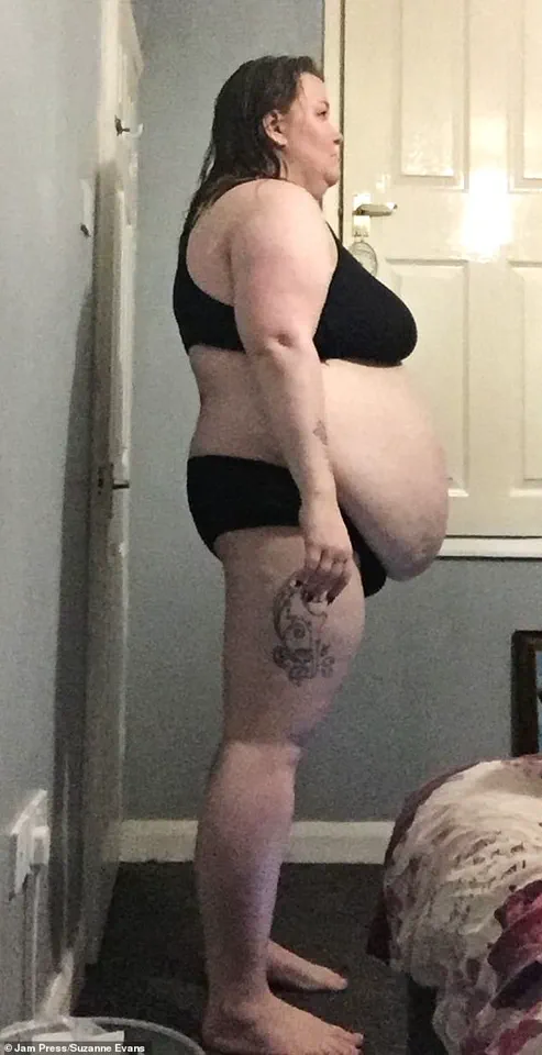 From Life-Threatening Obesity to 280 Pounds Lost: Suzanne Evans' Journey with Doctors' Warnings and a New Lease on Life